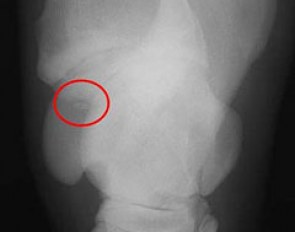 This is an example of how an OCD fragment typically looks on a radiograph.  The OCD fragment seems to “float” within a defect in the main bone