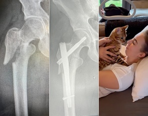 Bad luck for Stephanie Kooijman. She fractured her right hip in a fall off a horse on 12 March 2022