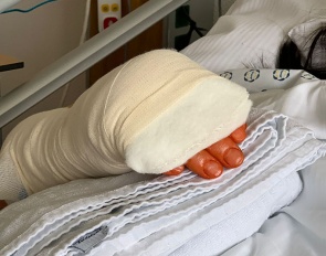 Susanne Szeltner required hand surgery after a barn accident :: Photo © private