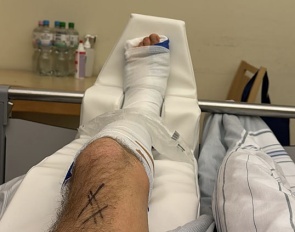 William Matthew fractured his ankle