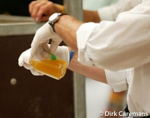A urine test to check for banned substances and controlled medication :: Photo © Dirk Caremans