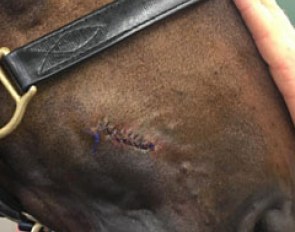 Delauney's stitches after injuring himself in the box at the 2017 Swedish Championships